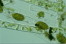 Spirogyra