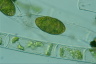 Spirogyra