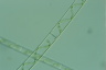 Spirogyra