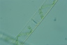 Spirogyra