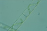 Spirogyra