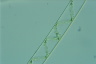 Spirogyra