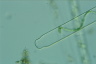 Spirogyra