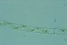 Spirogyra