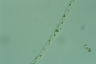 Spirogyra