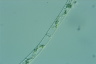 Spirogyra