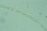 Spirogyra