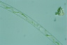 Spirogyra