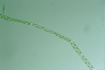 Spirogyra