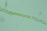 Spirogyra