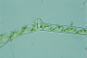 Spirogyra