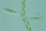 Spirogyra