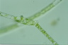 Spirogyra