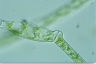 Spirogyra