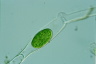 Spirogyra