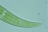 Closterium moniliferum