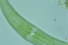 Closterium moniliferum