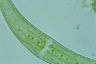 Closterium moniliferum