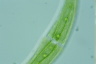 Closterium moniliferum