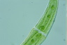 Closterium moniliferum