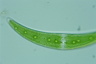 Closterium moniliferum