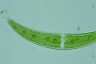 Closterium moniliferum