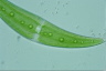 Closterium moniliferum