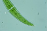 Closterium moniliferum