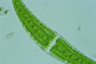 Closterium moniliferum