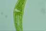 Closterium ehrenbergii