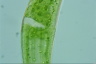 Closterium ehrenbergii