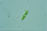 Closterium navicula