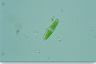 Closterium navicula