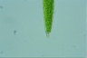 Closterium acerosum