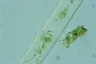 Closterium acerosum