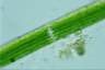 Closterium acerosum