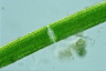 Closterium acerosum