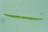 Closterium intermedium