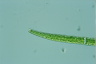 Closterium intermedium