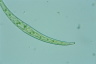 Closterium dianae