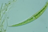 Closterium dianae