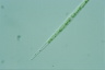 Closterium idiosporum