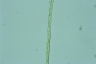 Closterium gracile