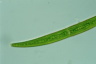 Closterium intermedium