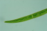 Closterium intermedium