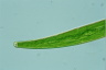 Closterium intermedium