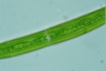 Closterium intermedium