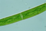 Closterium intermedium