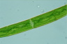 Closterium intermedium