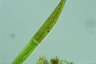 Closterium intermedium